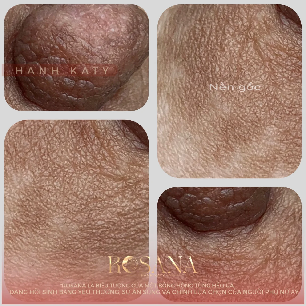 Nền gốc trước khi làm Rosana
